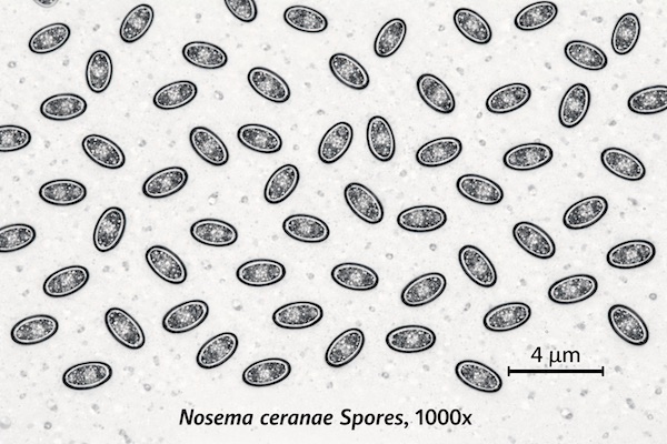 Microscopic view of Nosema ceranae spores at 1000x magnification for clinical apiary diagnosis